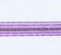 Klik her for at se flere billeder og f� mere information om varen:&nbsp; 0910 Susifix Bånd - Lilla m. Guld - 25mm *SIDSTE REST*